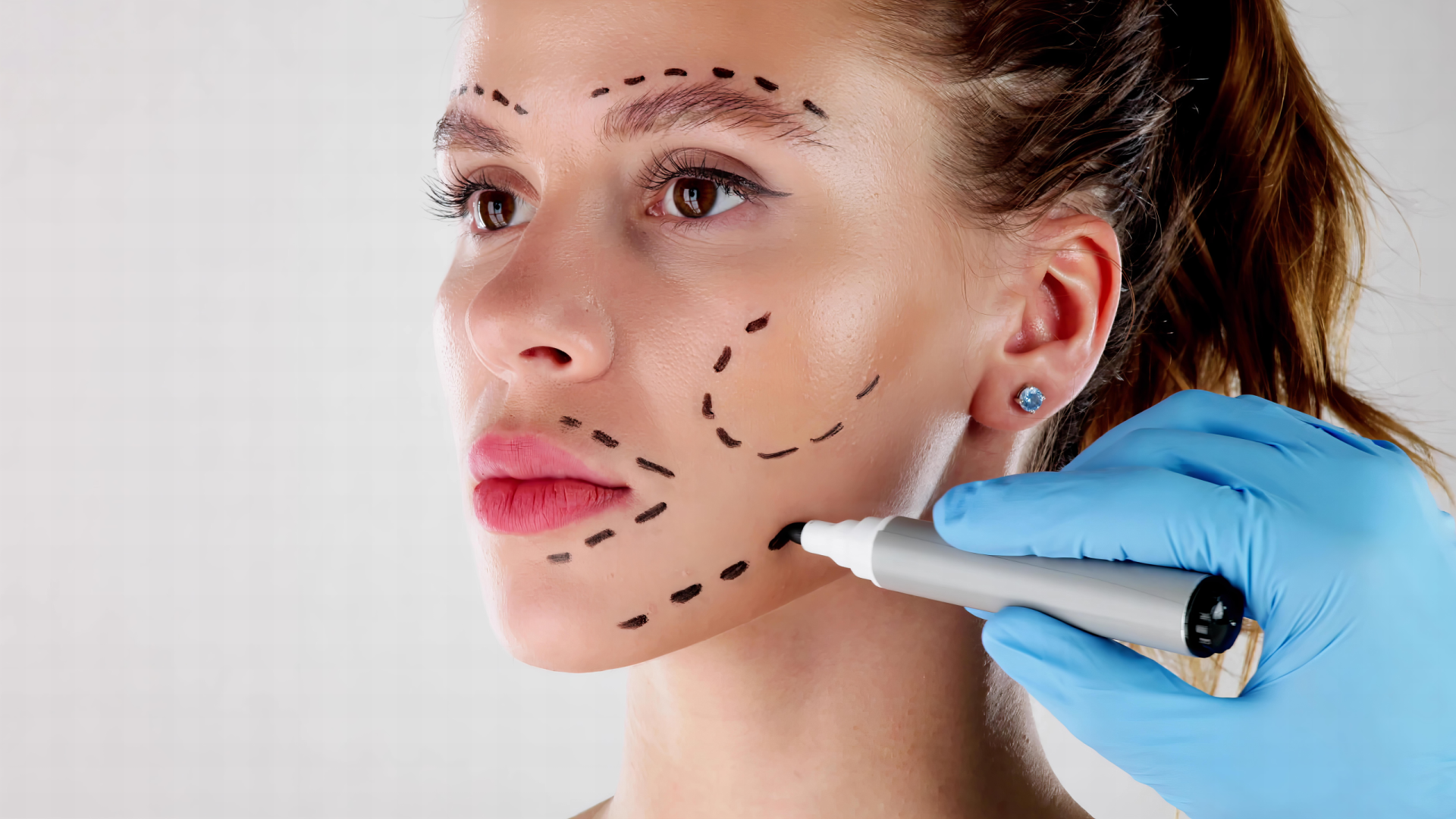 Plastic Surgery