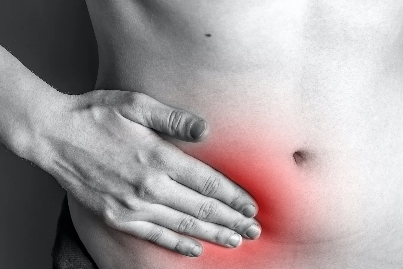 Hernia Surgery