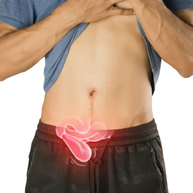 Hernia Surgery in Dubai