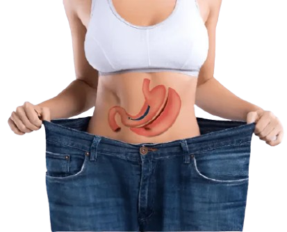 Bariatric Procedures offered in Dubai