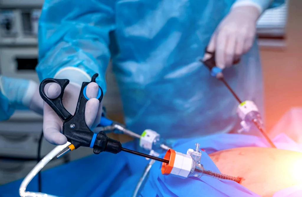 Weight Loss with Restrictive Bariatric Surgery