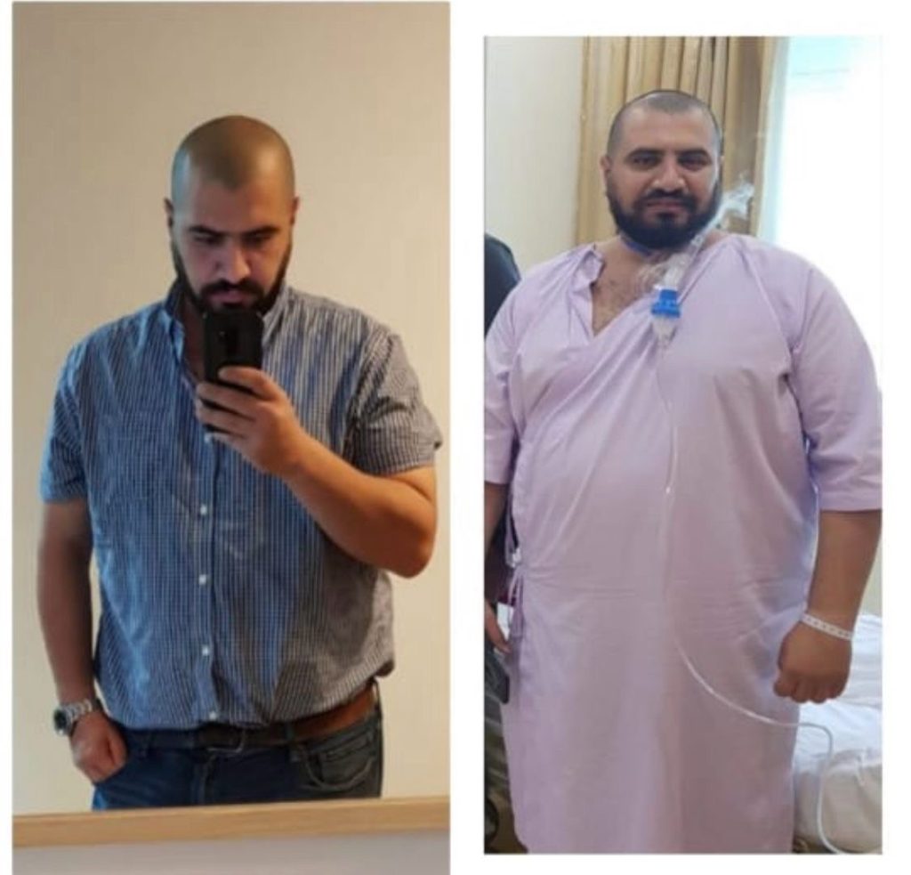 Transform Your Life with Scientifically Proven Weight Loss Methods