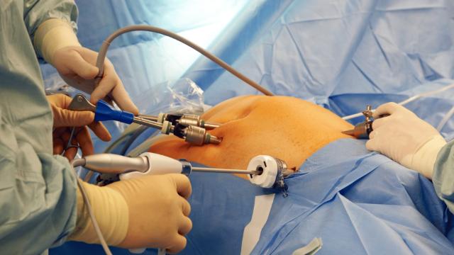 Transform Your Life with Bariatric Surgery: Weight Loss Through Gastric Sleeve and Gastric Bypass