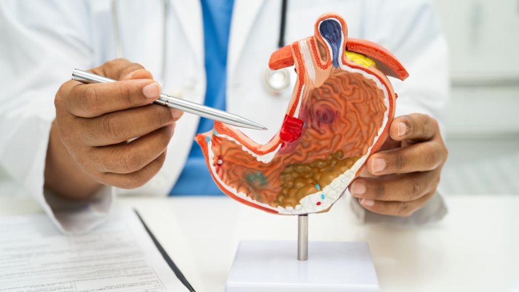 Why More People Are Choosing Gastric Sleeve and Bypass for Long-Term Weight Loss