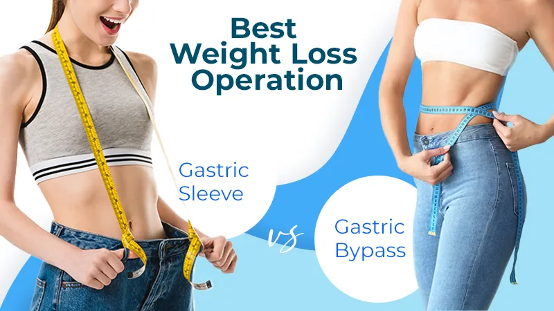 Weight Loss: Gastric Sleeve vs Bypass Surgery