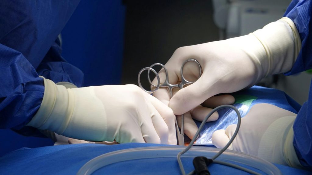 Robotic Surgery