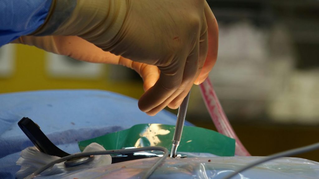 Thyroid Surgery