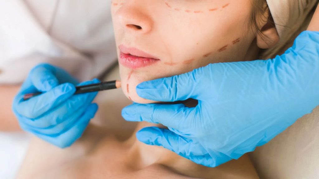 plastic-surgery-trends-region