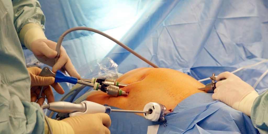 Benefits of the Laparoscopic and Robotic Approach